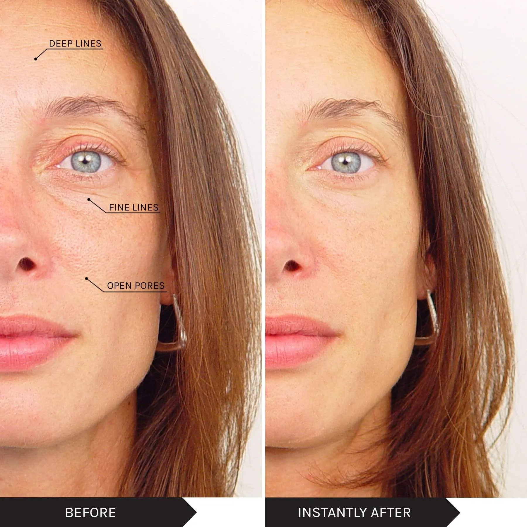 Skin Routine - Target Dry Skin